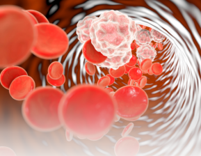 O que é inflamação