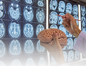 Análise da disfunção cerebral