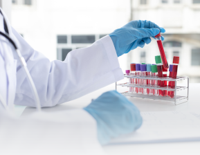 Demência foi associada a flutuações nos lipídios do sangue ao longo do tempo