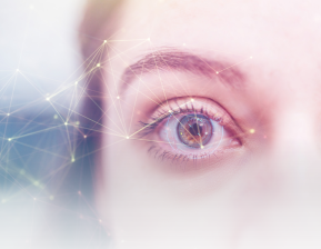 Oclusão da Artéria da Retina